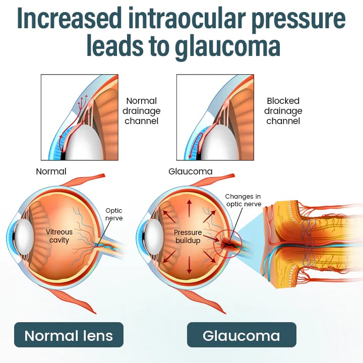 OptiFusion Nano Eye Drops Serum —Nano Technology Restores Clear Vision, No Glasses, No Surgery