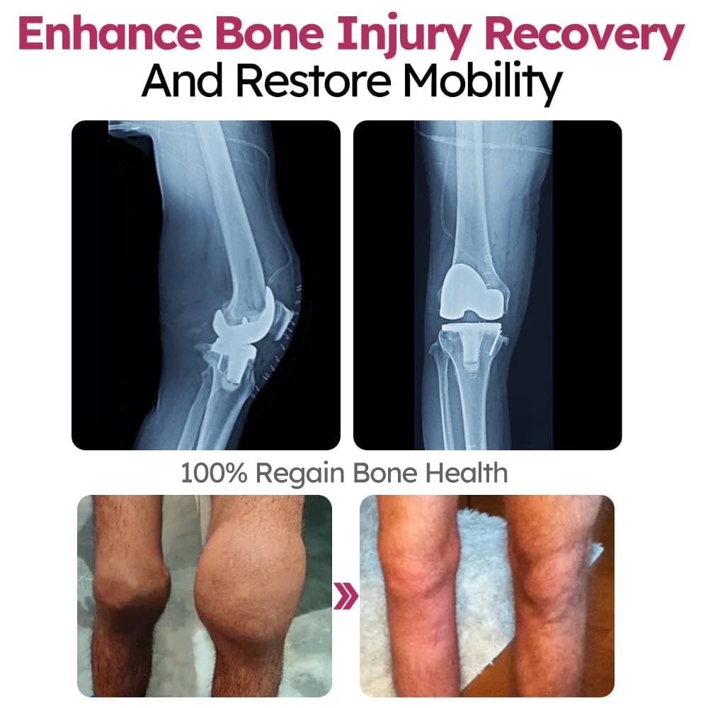 Vunkii™ Advanced Joint & Bone Renewal Cream