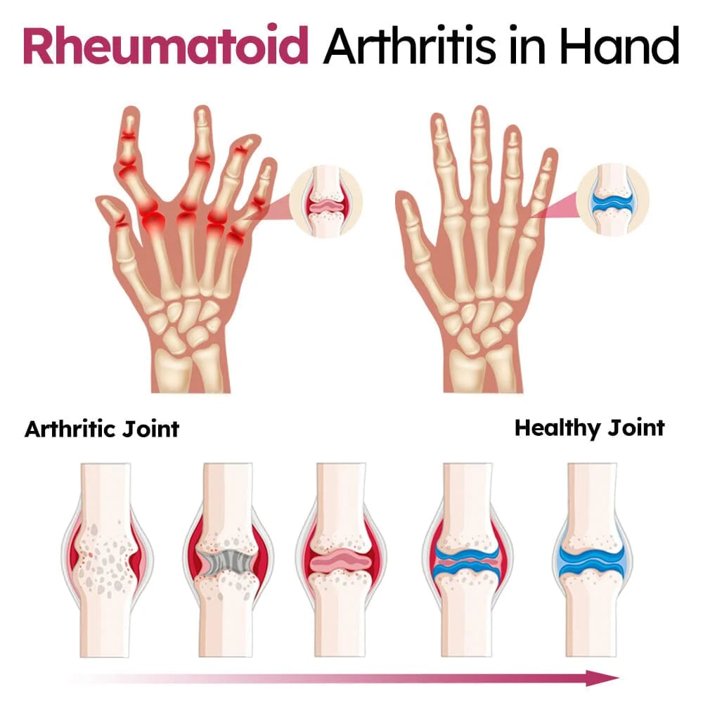 Vunkii™ Advanced Joint & Bone Renewal Cream
