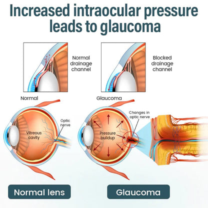 OptiFusion Nano Eye Drops Serum —Nano Technology Restores Clear Vision,  No Glasses, No Surgery