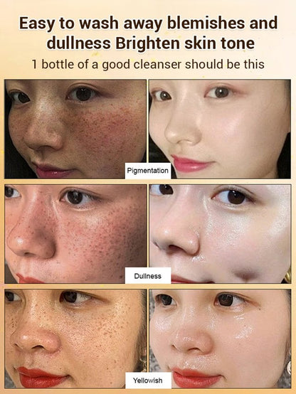 Upgraded anti-freckle essence oil