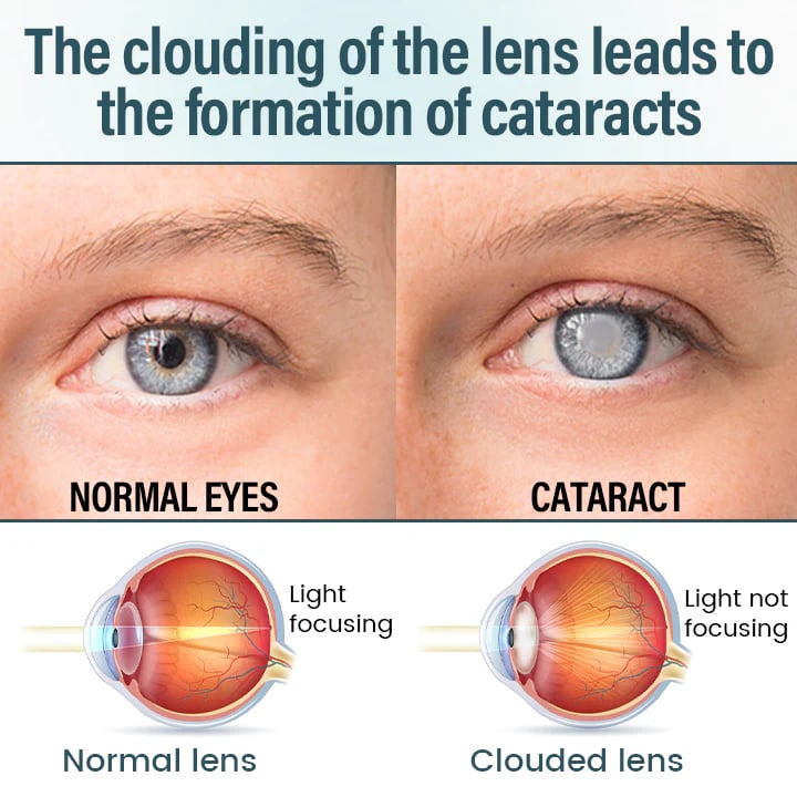 OptiFusion Nano Eye Drops Serum —Nano Technology Restores Clear Vision,  No Glasses, No Surgery