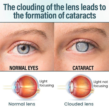 OptiFusion Nano Eye Drops Serum —Nano Technology Restores Clear Vision,  No Glasses, No Surgery