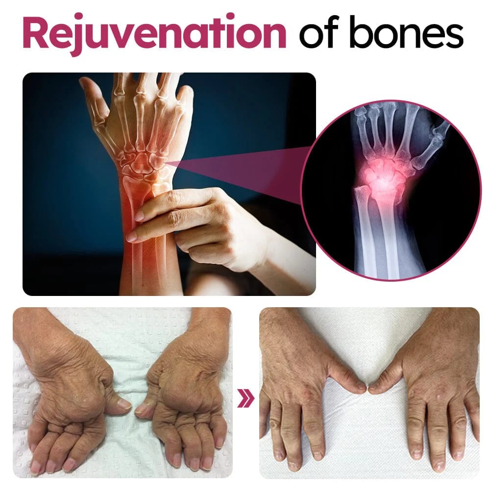 Vunkii™ Advanced Joint & Bone Renewal Cream