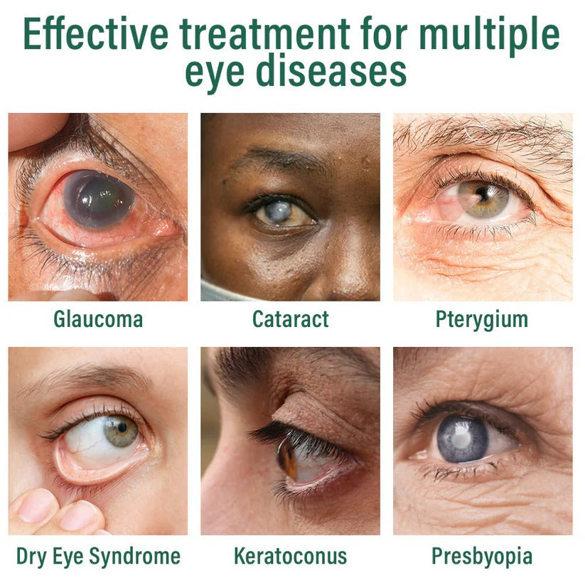 OptiFusion Nano Eye Drops Serum —Nano Technology Restores Clear Vision,  No Glasses, No Surgery