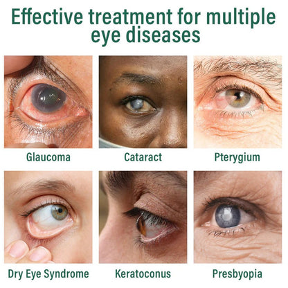 OptiFusion Nano Eye Drops Serum —Nano Technology Restores Clear Vision,  No Glasses, No Surgery