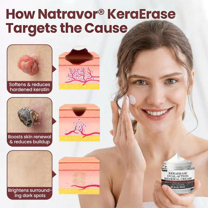 KeraErase Dual-Action Renewal Cream